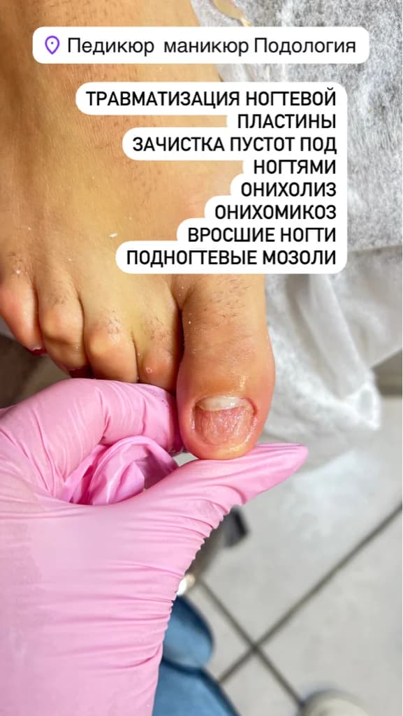 Фото услуги Сложный педикюр с покрытием гель-лака