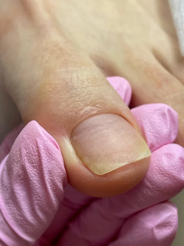 Ещё 2 фото услуги Педикюр аппаратный