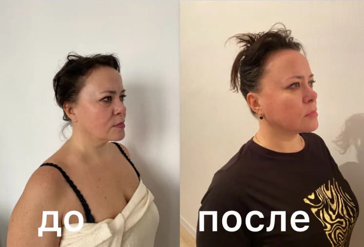 Фото услуги Массаж лица и головы коруги