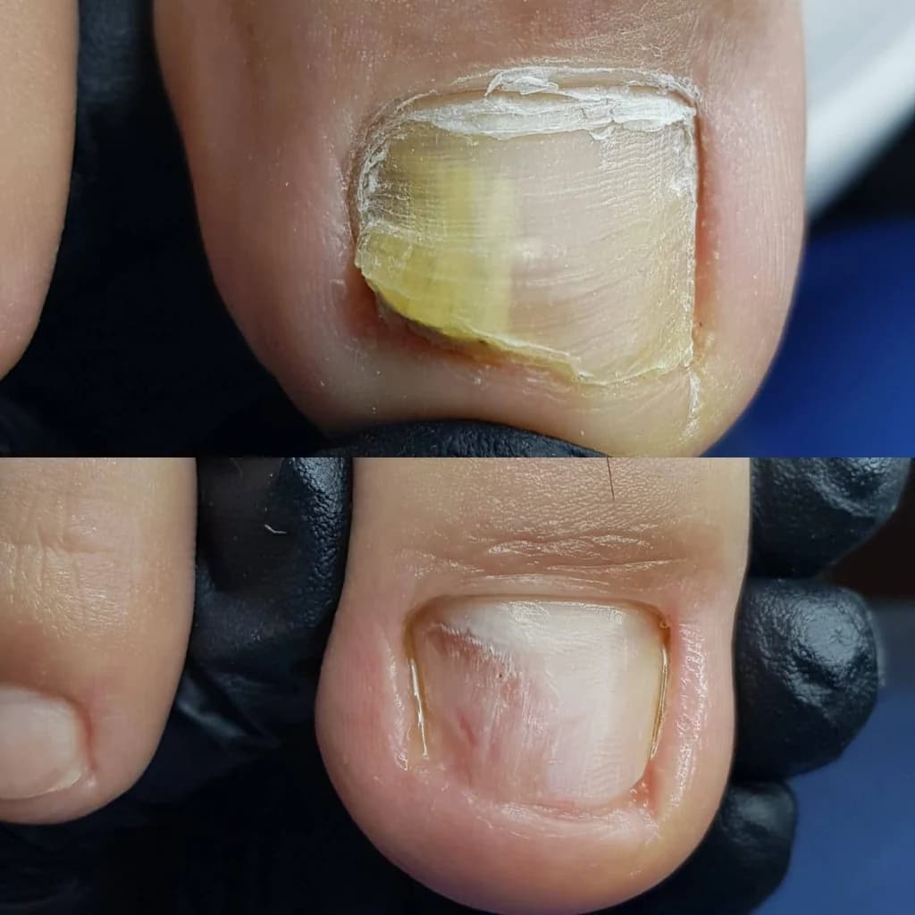 Фото услуги Педикюр подологический