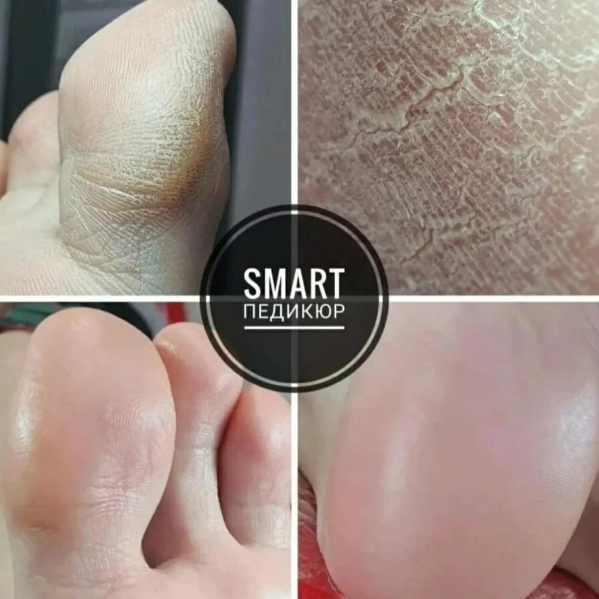 Фото услуги Smart педикюр с покрытием гель-лак