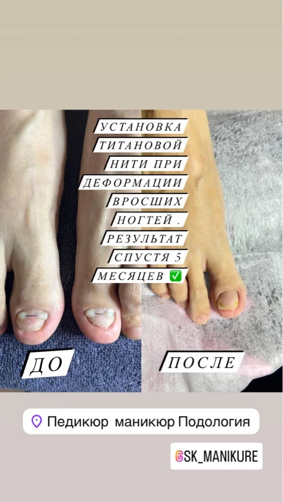 Фото услуги Сложный педикюр с покрытием гель-лака
