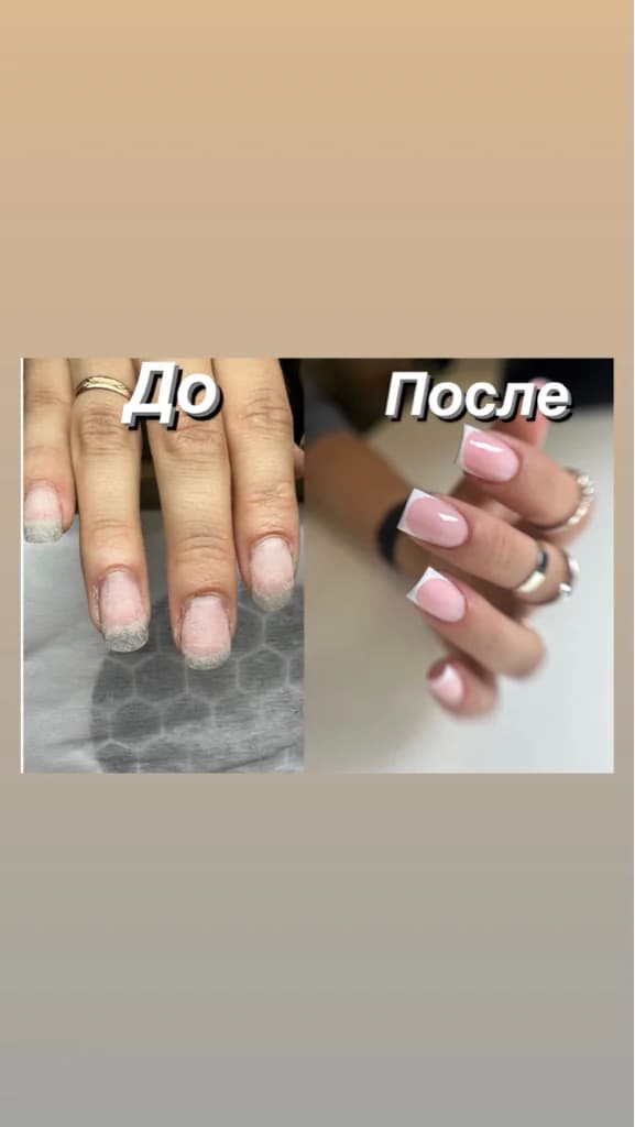 Фото услуги Наращивание ногтей