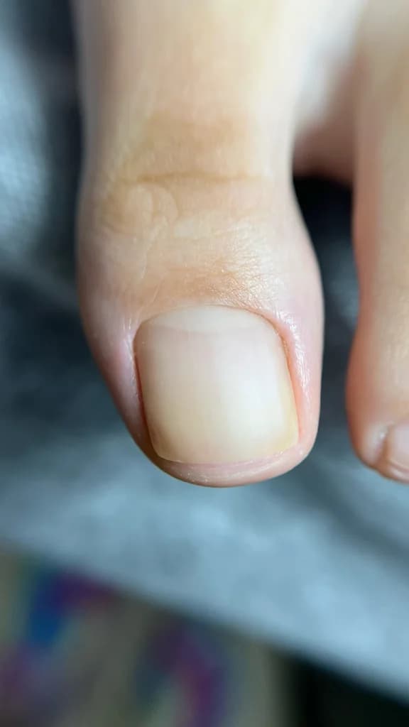 Фото услуги Педикюр комбинированный аппаратный