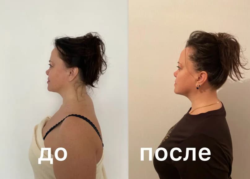 Фото услуги Массаж лица и головы коруги