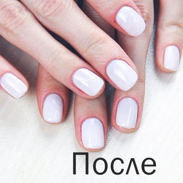 Ещё 1 фото услуги Маникюр аппаратный, обработка онихолизиса