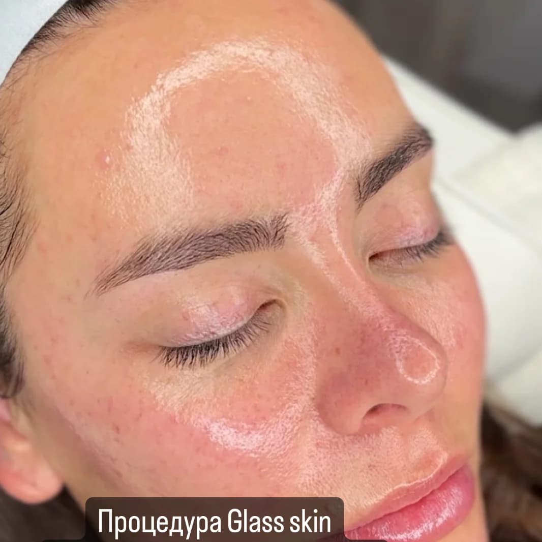 Фото услуги Glass skin