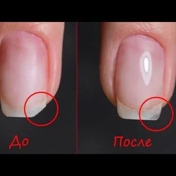 Записаться на услугу Ремонт ногтя
300₽