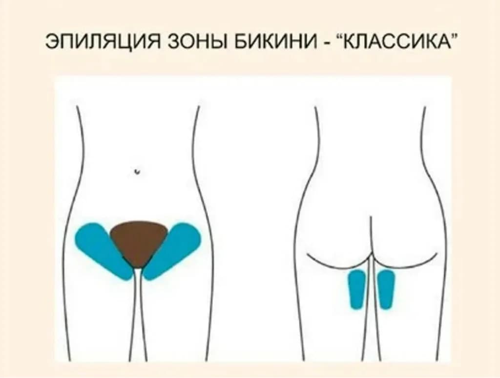 Записаться на услугу Депиляция женская - классическое бикини
