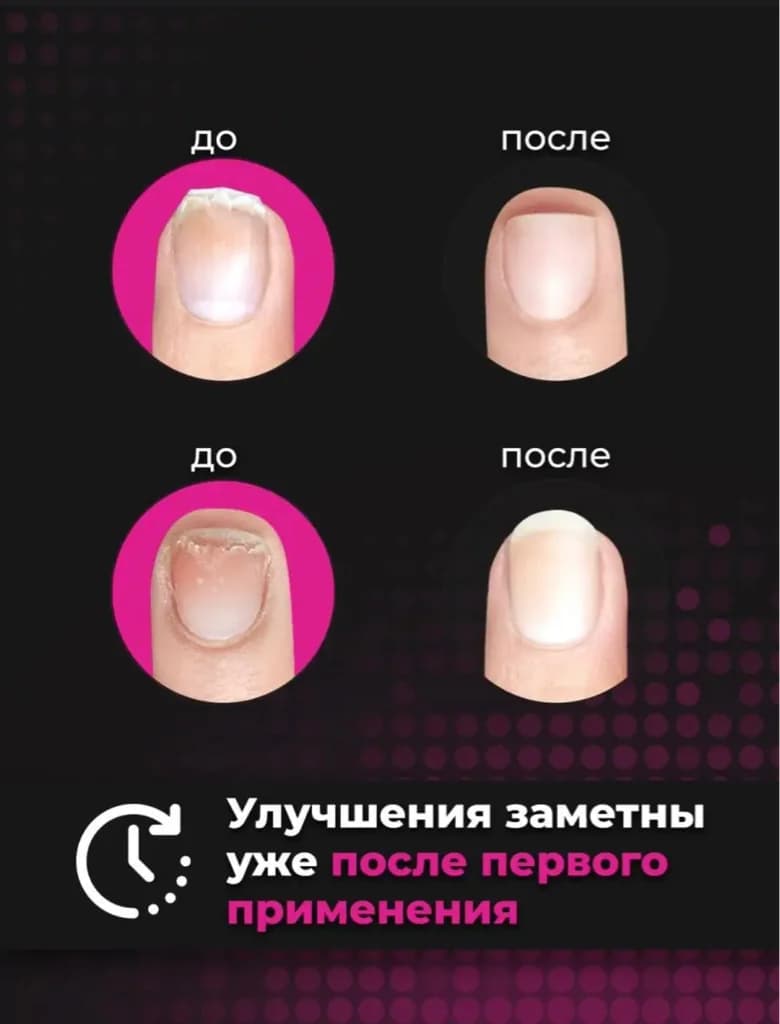 Фото услуги Восстановление ногтевой пластины -ibx.