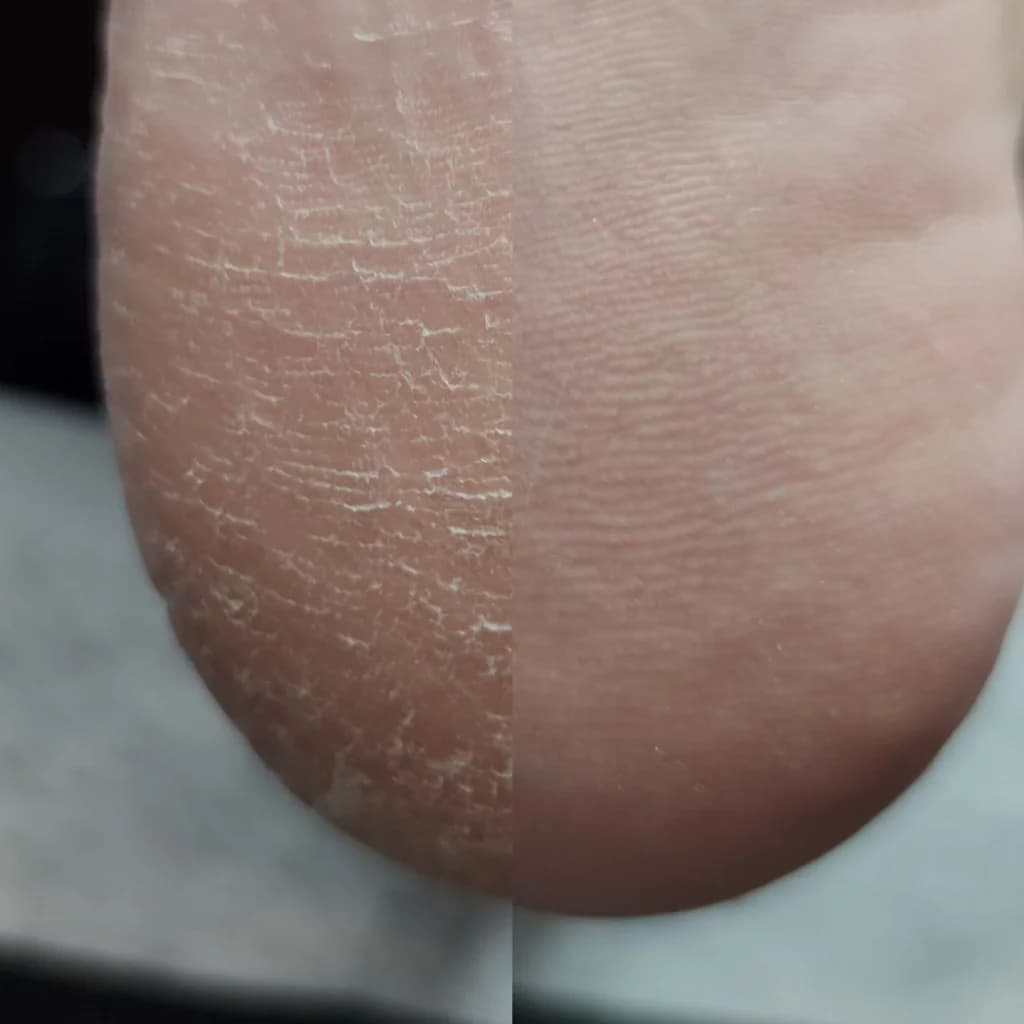 Фото услуги Педикюр без покрытия