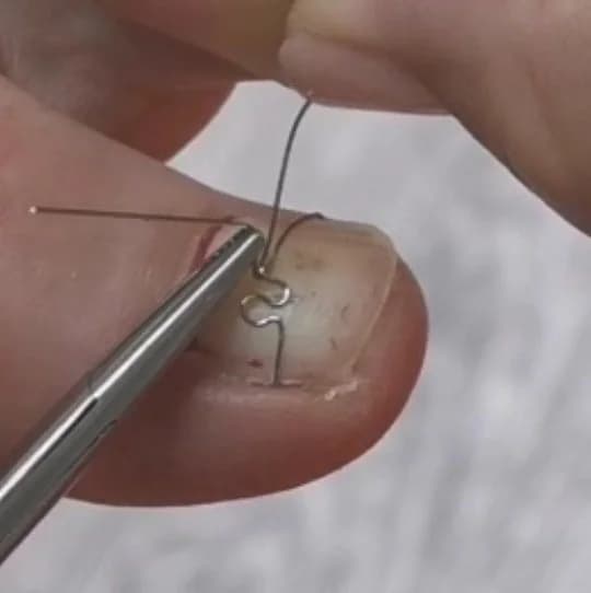 Фото услуги Установка корректирующей системы