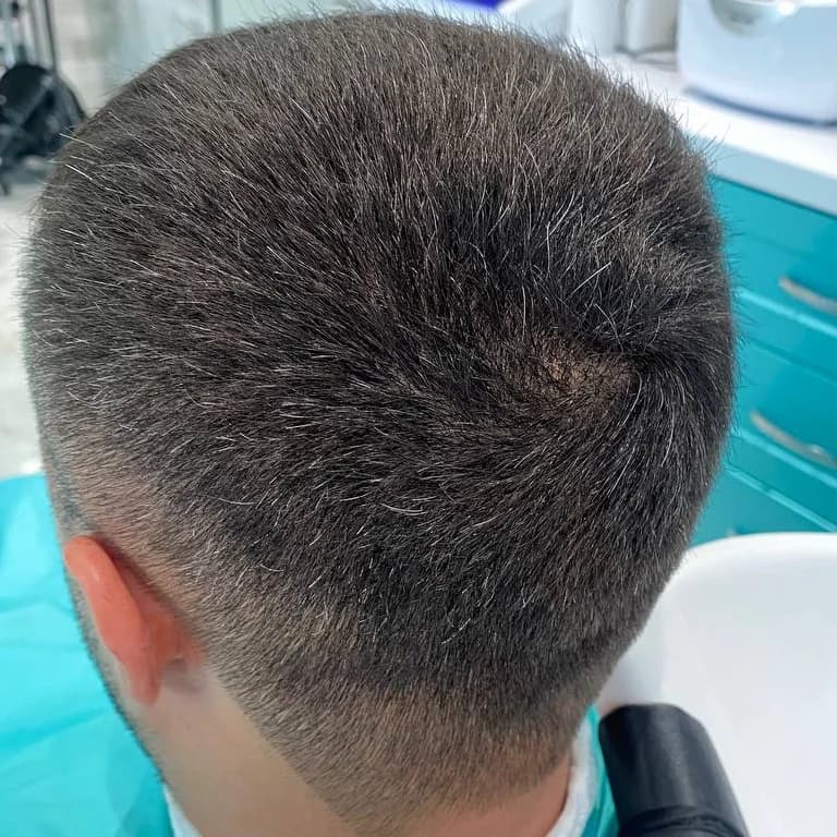 Фото услуги Камуфляж седины для мужчин