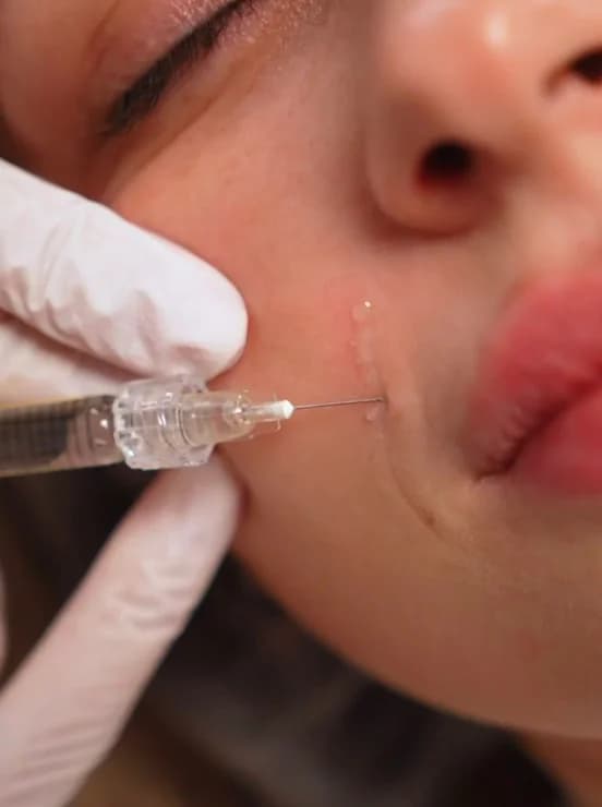 Фото услуги Инъекционная косметология