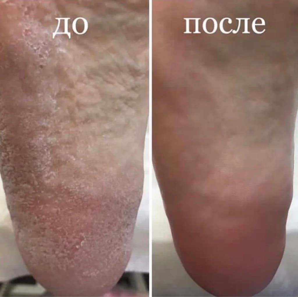 Фото услуги Smart педикюр