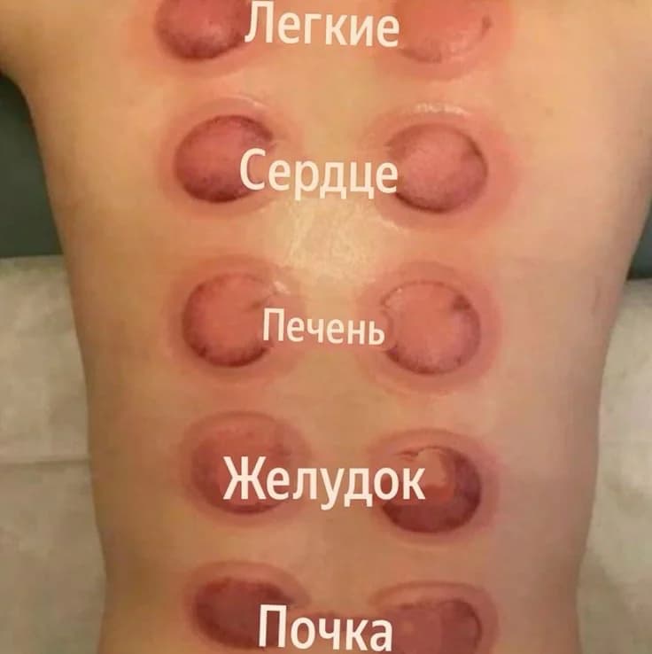 Записаться на услугу Массаж спины + банка наиболее эффективный и самый быстрый способ снятия накопившейся усталости и спазмов в мышцах после физических и умственных нагру