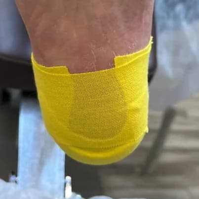 Фото услуги Окклюзионная повязка