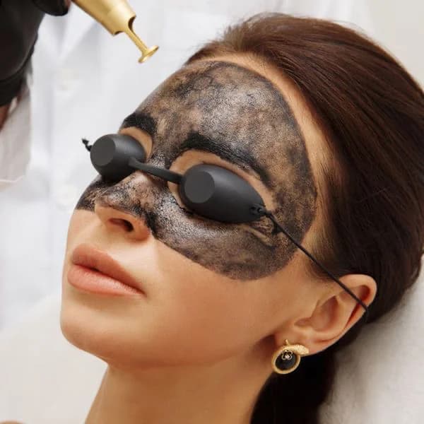 Записаться на услугу Карбоновый пилинг лицо 100% результат