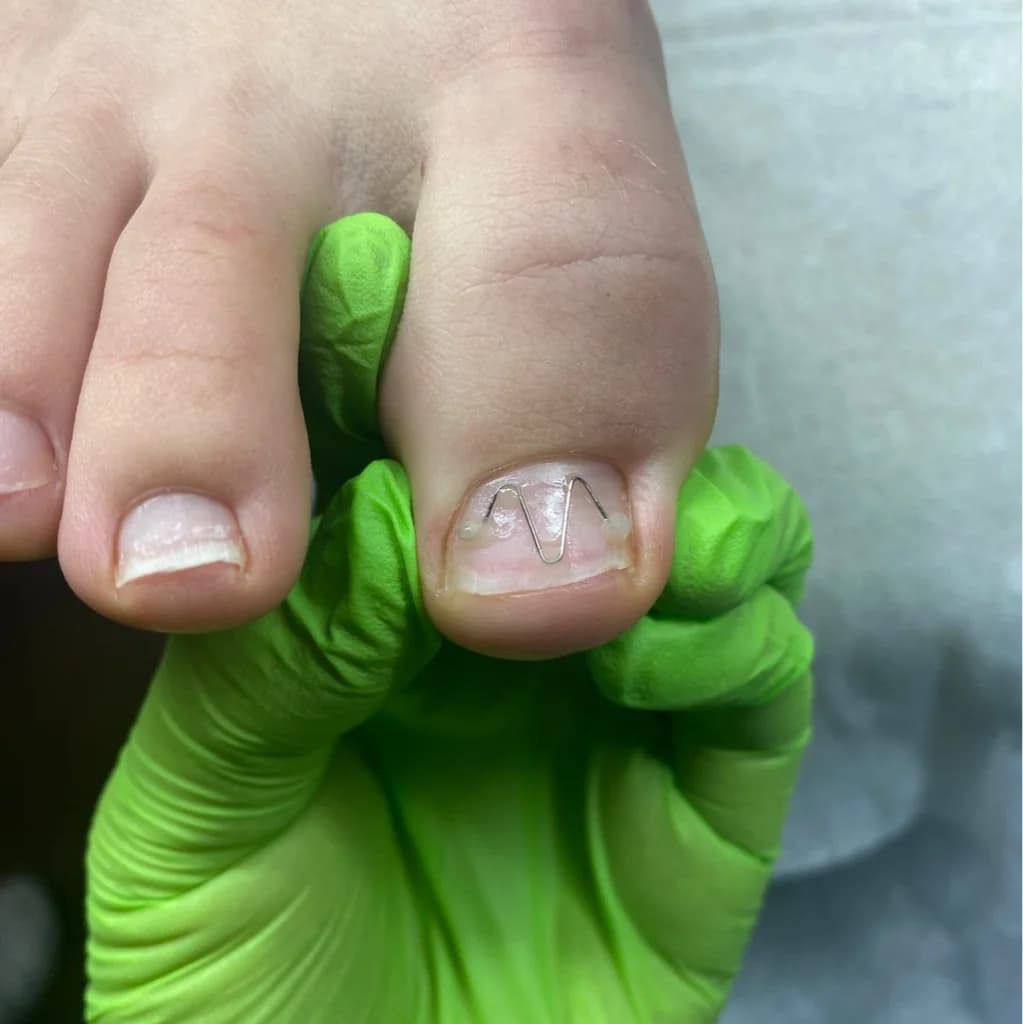 Фото услуги Коррекционная система uni-brace