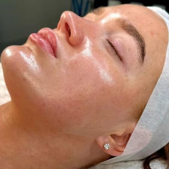 Фото услуги Пилинг peach peel суперфуд для кожи с эффектом биоревитализации
