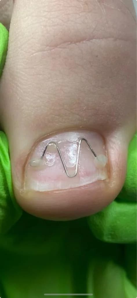 Фото услуги Коррекционная система uni-brace
