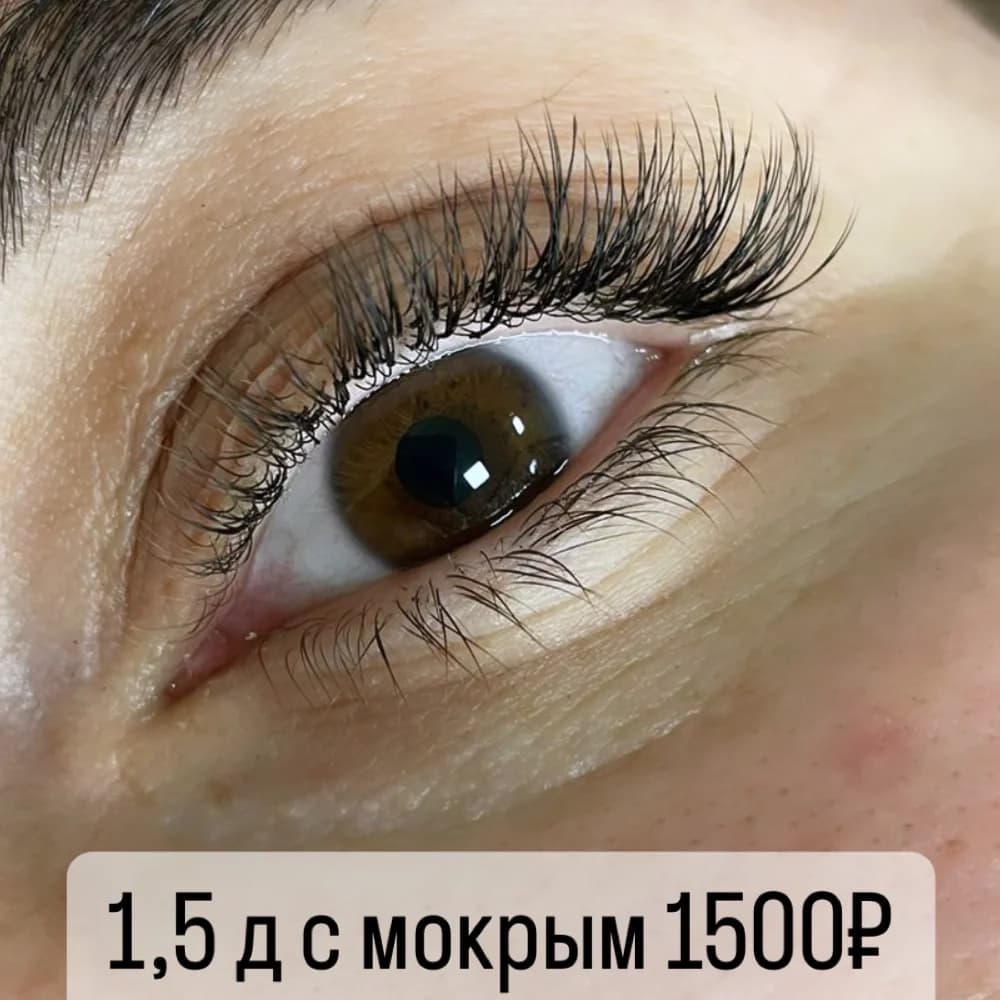 Фото услуги 2.0д