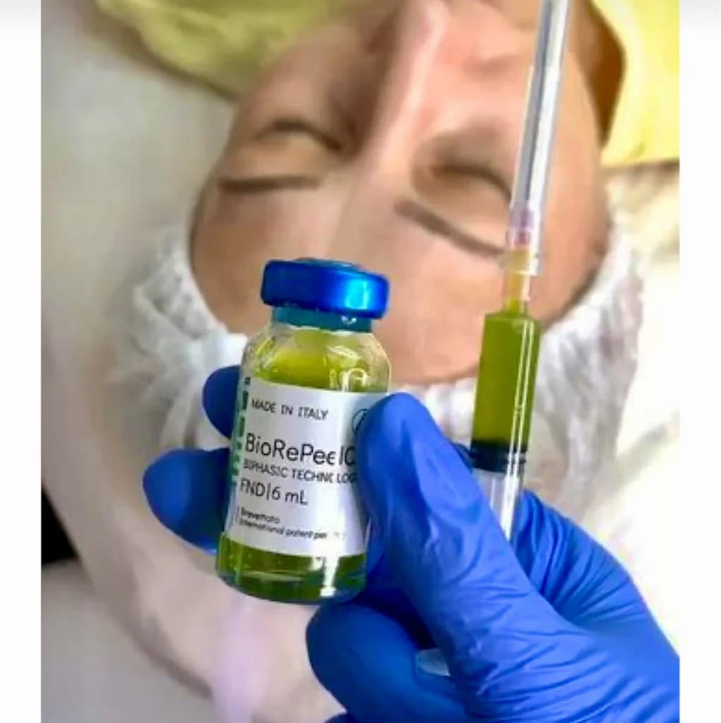 Фото услуги Пилинг по типу кожи ( bioreepil/ prx-t33/ джесснера/ желтый)