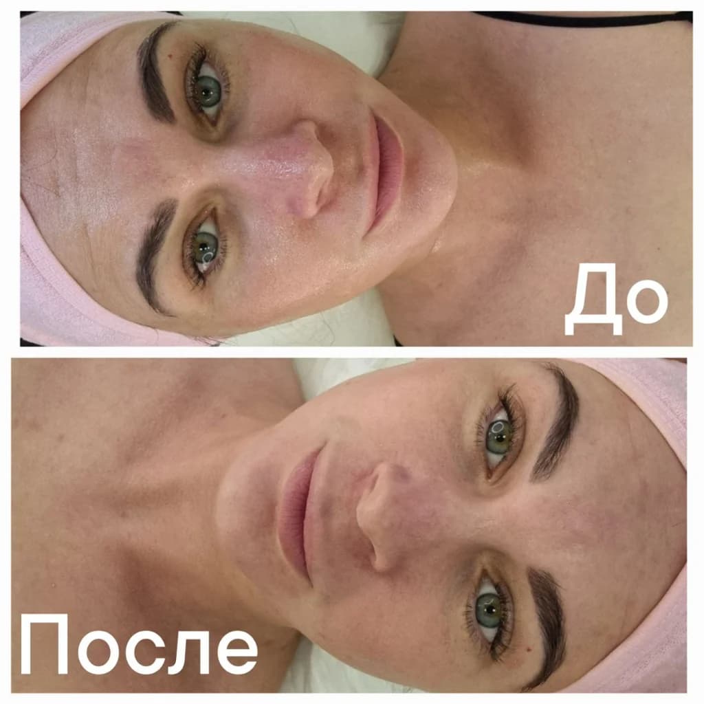 Записаться на услугу Аминотерапия
