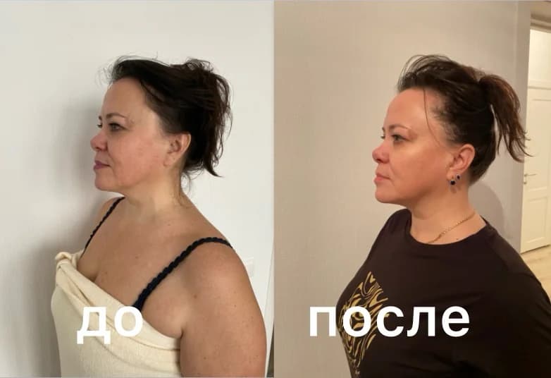 Записаться на услугу Массаж лица и головы коруги