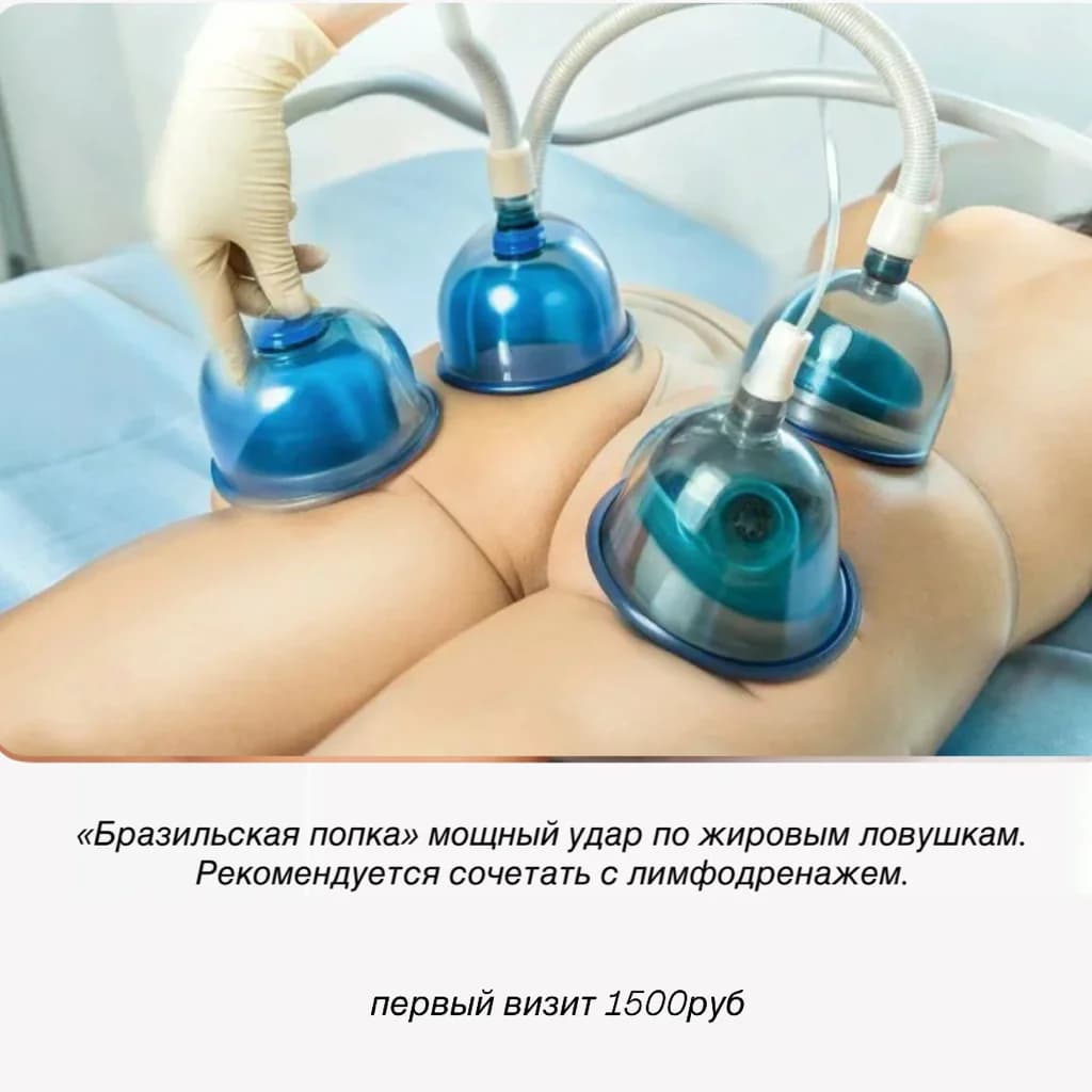Фото услуги «бразильская попка» баночный массаж