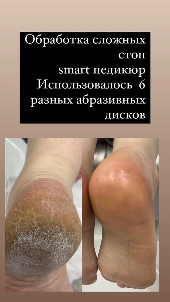 Фото услуги Снятие/смарт педикюр/покрытие