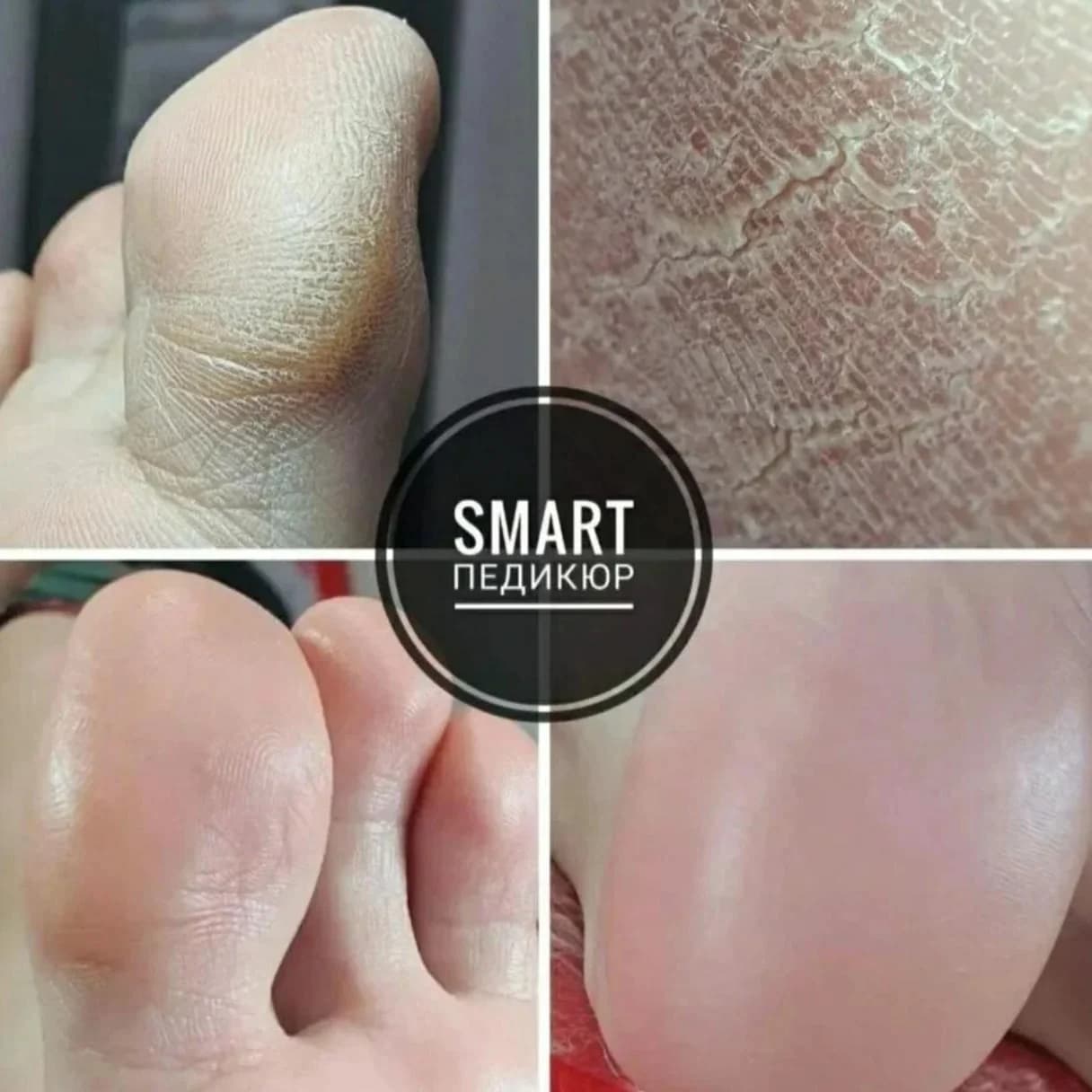 Фото услуги Smart педикюр без покрытия