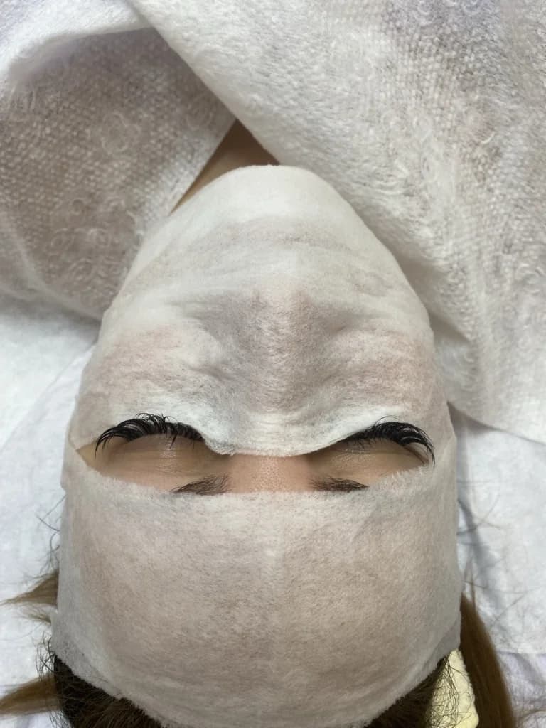 Фото услуги Комплексный уход 
экладо