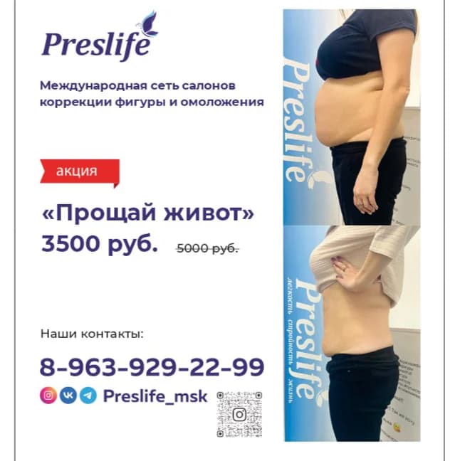 Фото услуги Прощай живот