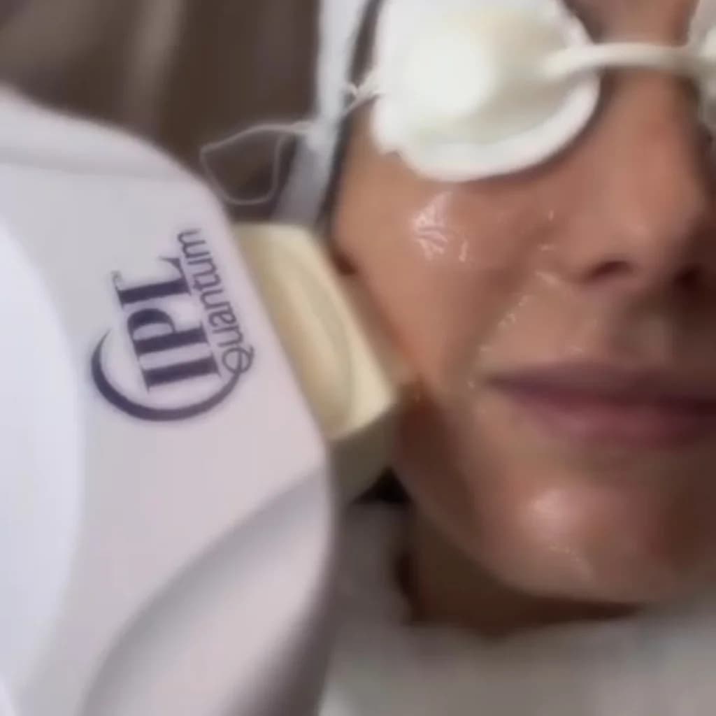Записаться на услугу Ipl-фотоомоложение шея + декольте