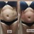 Фото услуги Авторская программа: Скульптуропластика живота