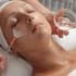 Фото услуги Пилинг поверхностный миндальный 