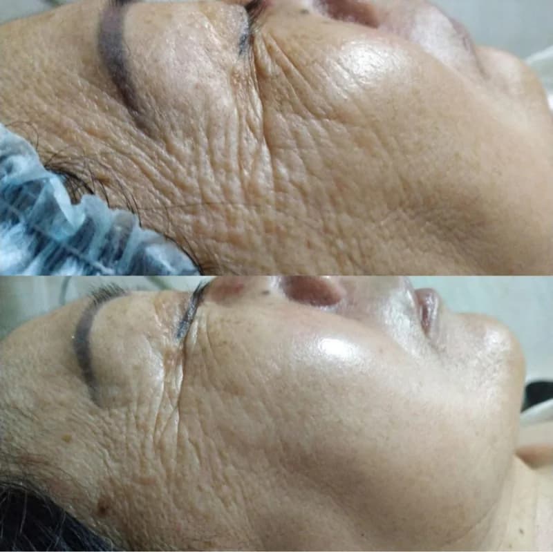 Пример работы Shié skin lab (3)