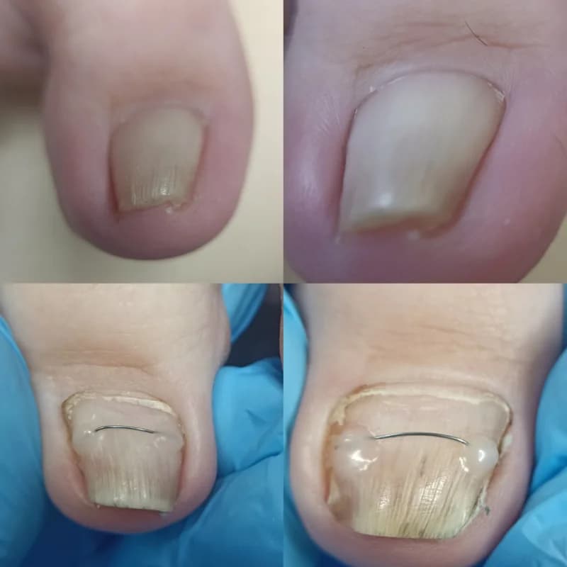 Пример работы EVA beauty room (9)