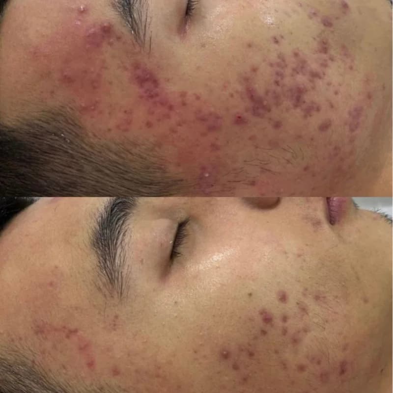 Пример работы Shié skin lab (2)