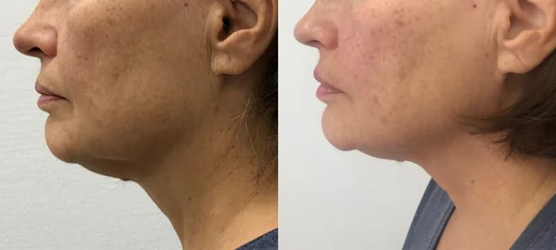 Пример работы Массаж лица в Рассказовке (4)