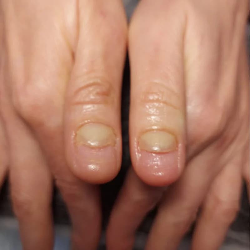 Пример работы Hands with soul (2)