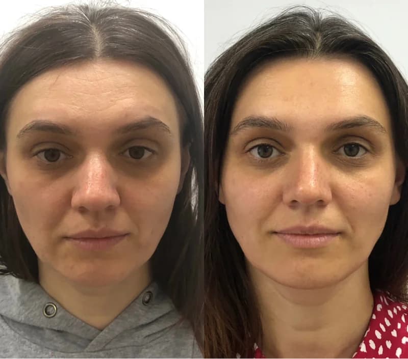 Пример работы Массаж лица в Рассказовке (2)