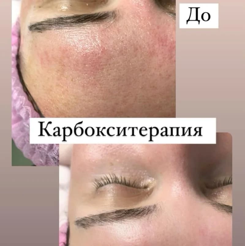 Пример работы Kate.lashlove Перово (6)